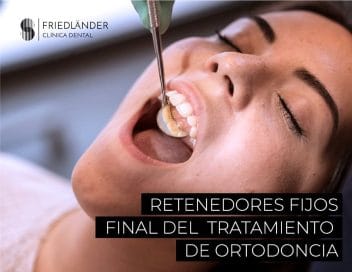 la retención