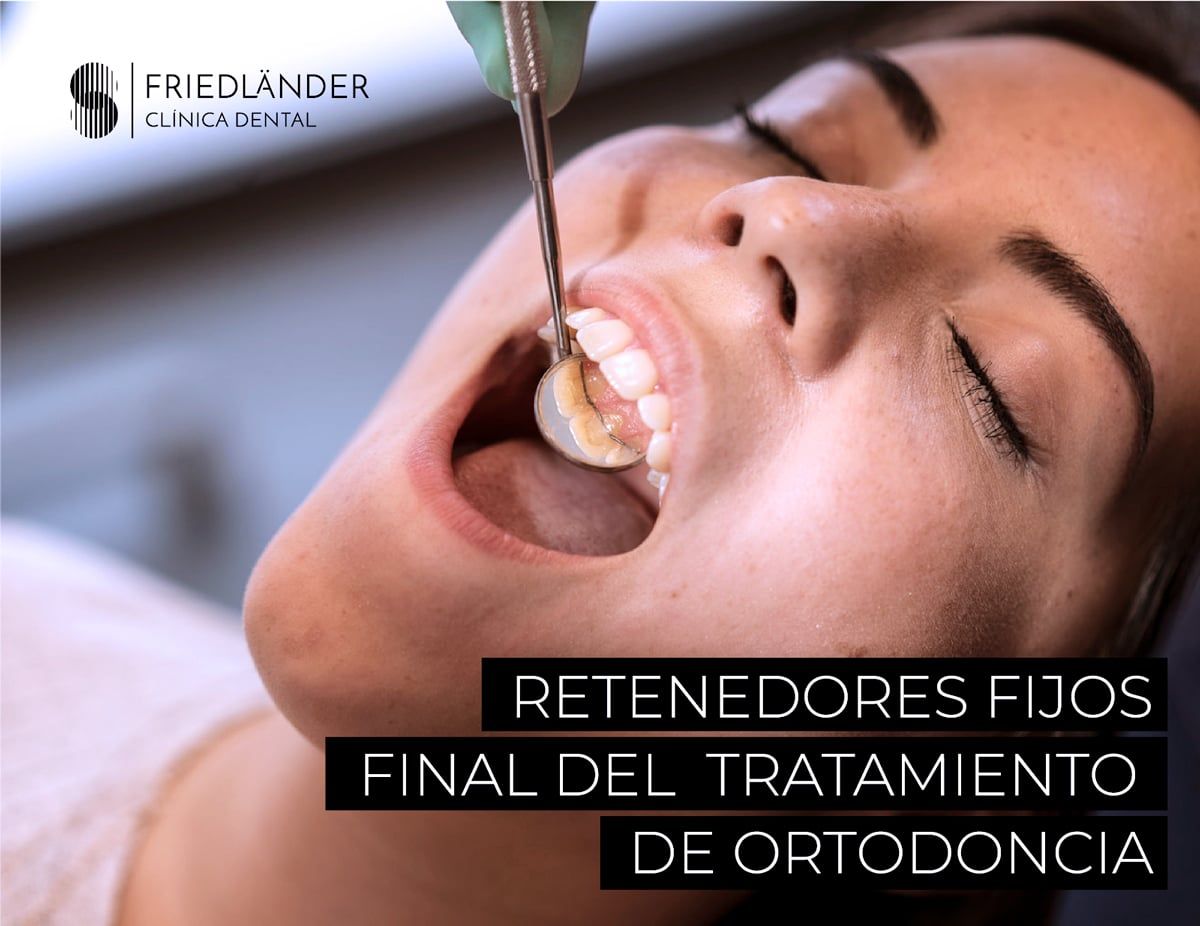 champú Caucho Irregularidades Retenedores fijos dentales | La retención fija en ortodoncia