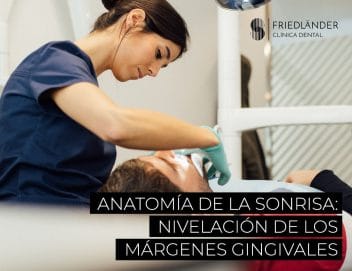 Anatomía de la sonrisa: nivelación de los márgenes gingivales