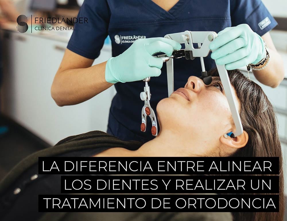alinear los dientes