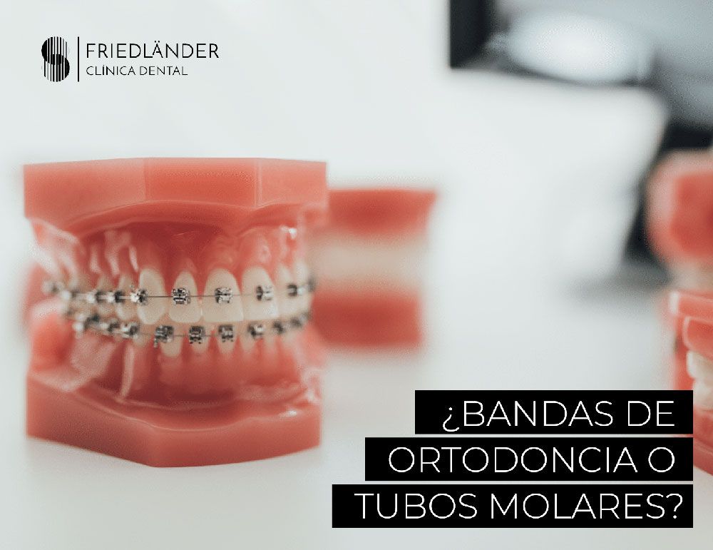 bandas de ortodoncia