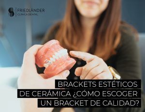 brackets estéticos de cerámica