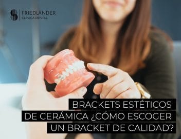 brackets estéticos de cerámica
