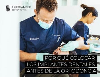 implantes dentales antes de la ortodoncia