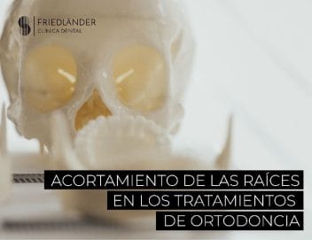 reabsorciones radiculares