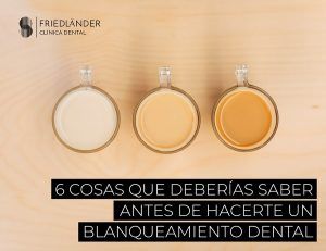 Blanqueamiento dental