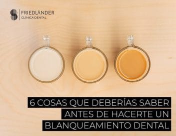Blanqueamiento dental