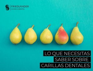 carillas dentales