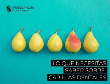 carillas dentales