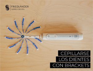 cepillarse los dientes con brackets