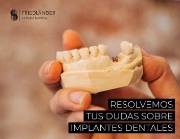qué es un implante dental