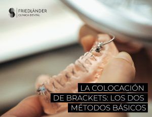 colocación de los brackets