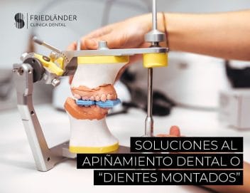 Tengo los dientes montados: ¿Cómo lo puedo solucionar?