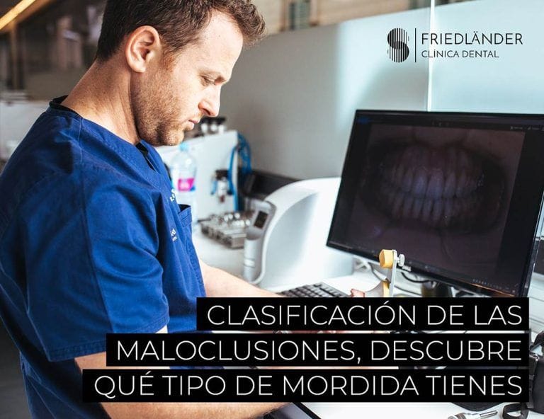 maloclusión dental