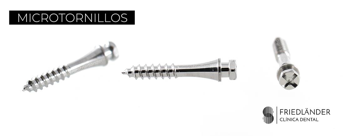 MICROTORNILLOS MICROTORNILLOS