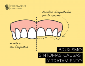 bruxismo síntomas causas y tratamiento