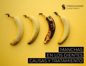 manchas en los dientes causas tipos y prevención