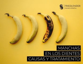 manchas en los dientes causas tipos y prevención