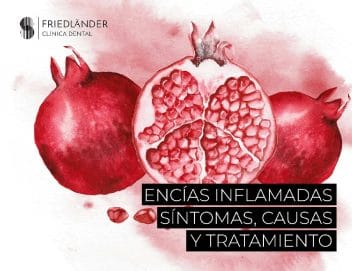 Encías inflamadas , síntomas, causas y tratamientos