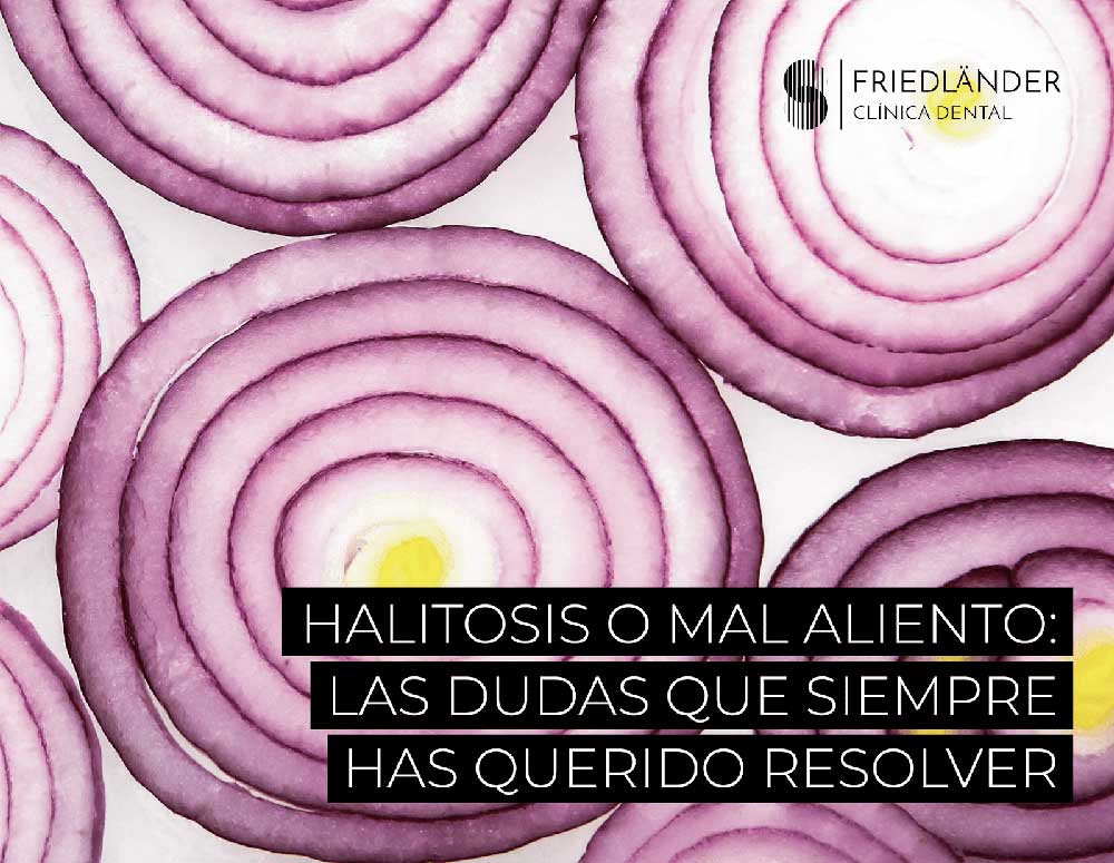 Halitosis o mal aliento