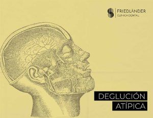 Deglución atípica