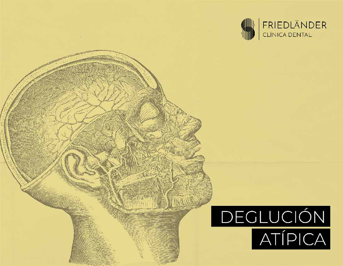 Deglución atípica