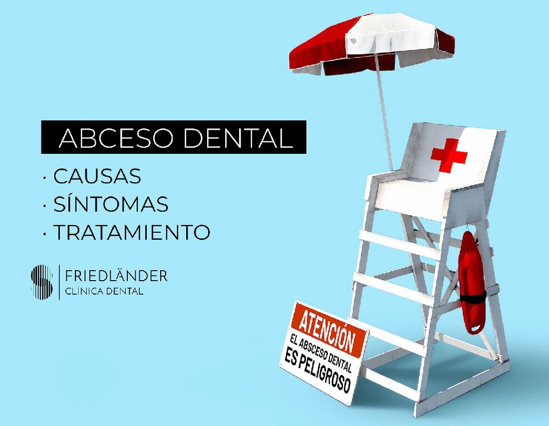 Absceso dental