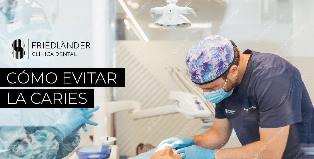 Cómo evitar las caries Cómo evitar las caries
