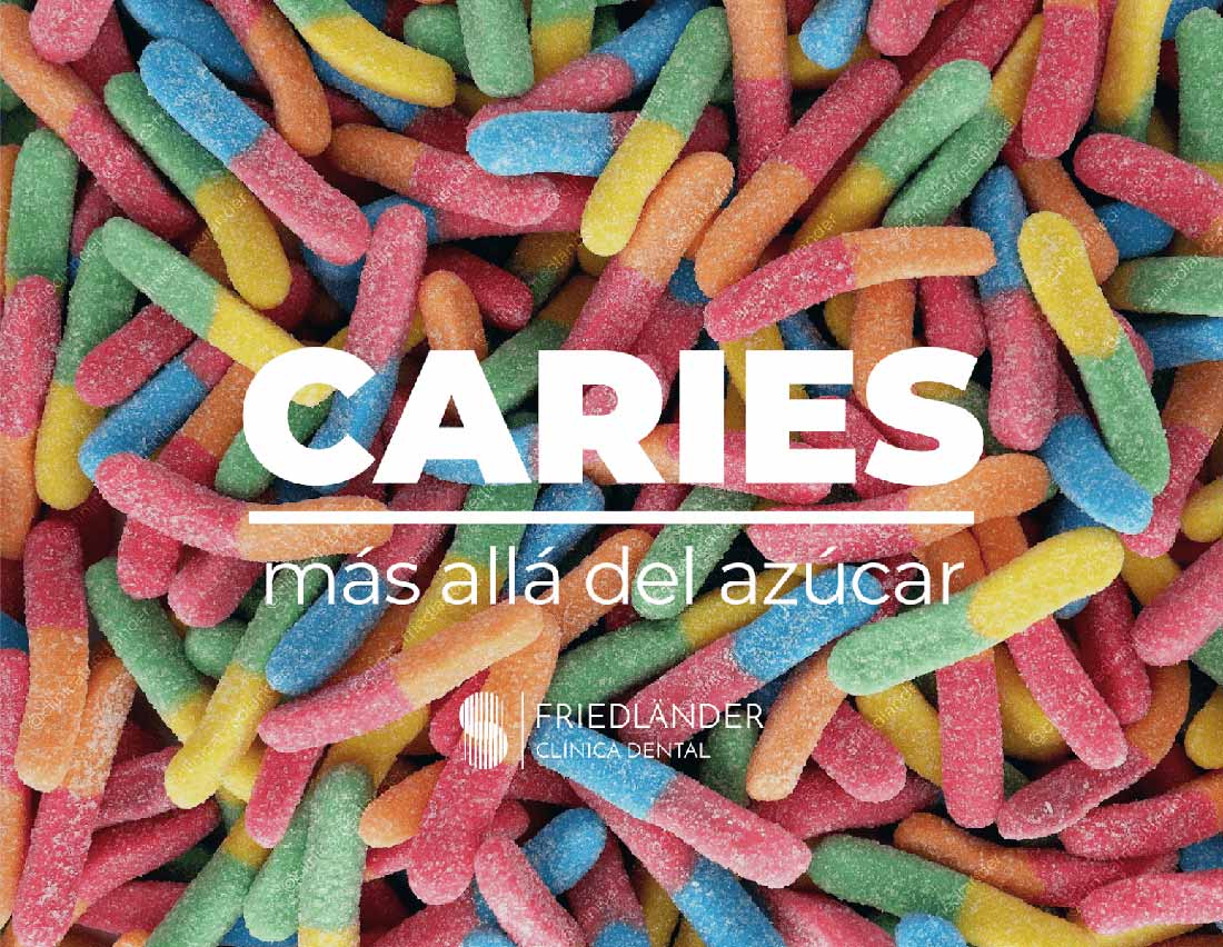 Caries dental: Qué son, cómo evitarlas y tratamiento.