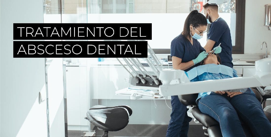 Tratamiento-abceso-dental-1
