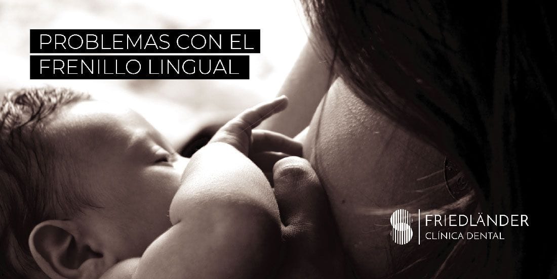 Problemas-con-el-frenillo-Lingual frenillo lingual alterado y lactancia