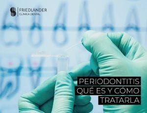 qué es la periodontitis o enfermedad periodontal