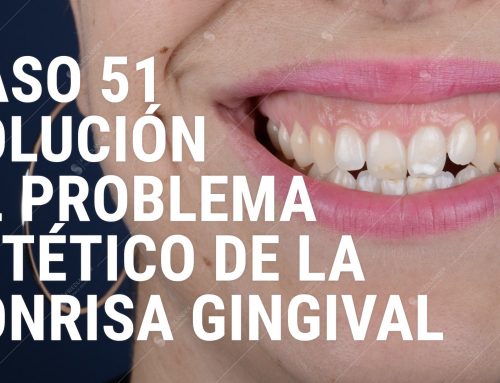Caso 51 – Solución al problema estético de la sonrisa gingival