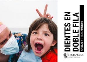 dientes en doble fila