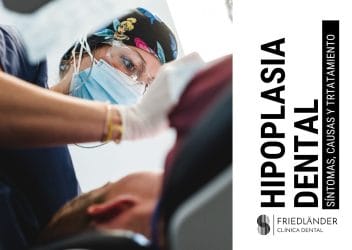 hipoplasia dental