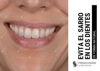 cómo evitar el sarro en los dientes