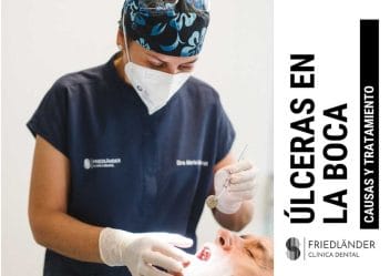 úlceras en la boca