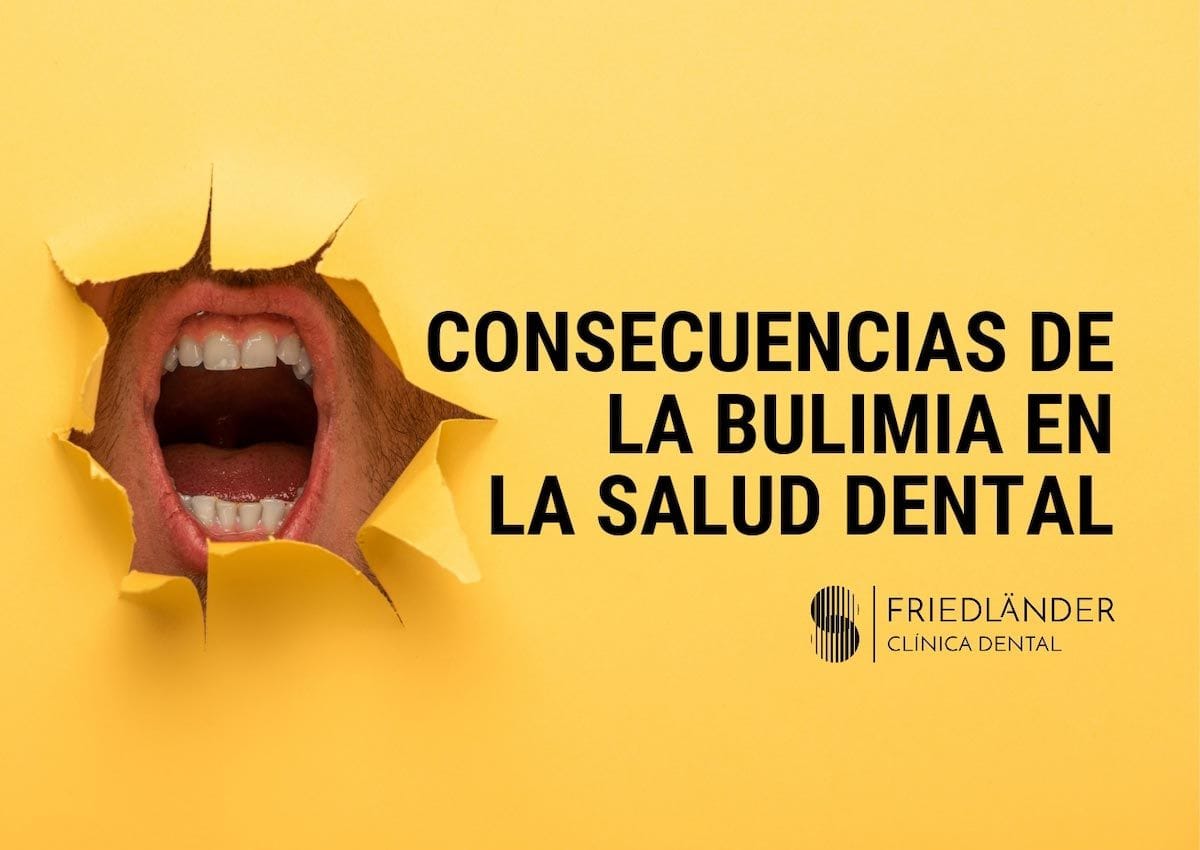 consecuencias de la bulimia para la salud bucodental