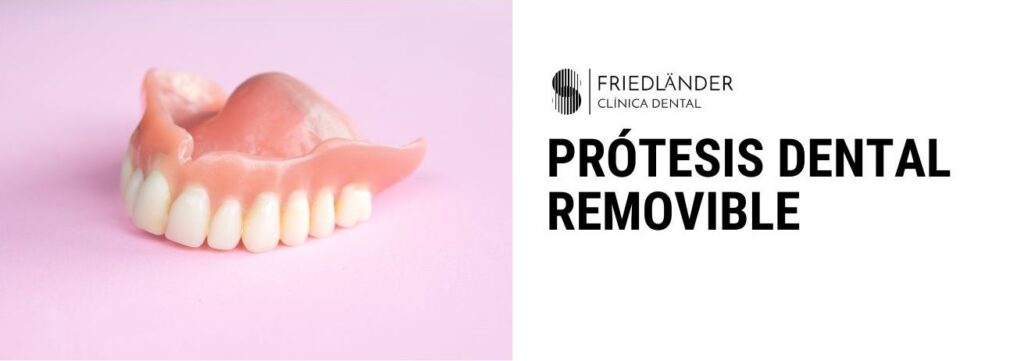 protesis dental removible