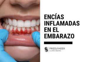 encías inflamadas en el embarazo