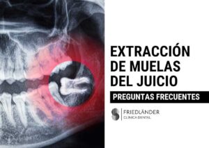 extracción de muela del juicio