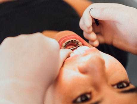 Clínica Friedländer • Ortodoncia lingual en Barcelona