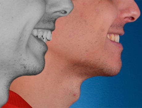 Clínica Friedländer • Ortodoncia quirúrgica en Barcelona