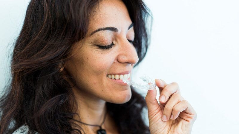 Ortodoncia Invisible Barcelona - Casos sencillos (12-15 meses)