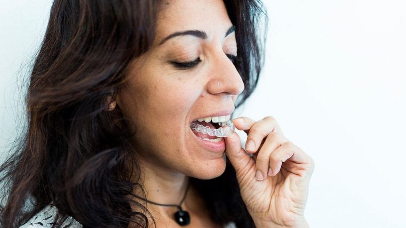 Ortodoncia Invisible Barcelona - Casos moderados (18 meses)