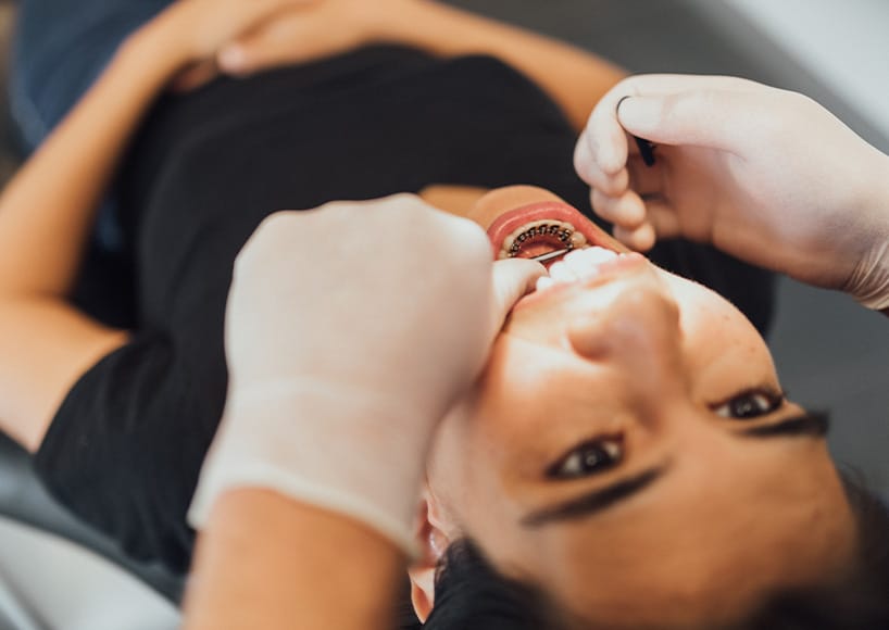 Ortodoncia Lingual • Equipo de ortodoncia Lingual especializado en casos personalizados