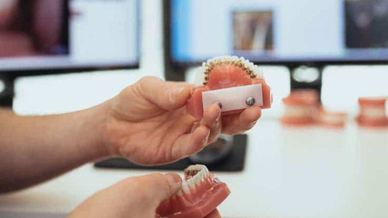 Ortodoncia Lingual Barcelona - Corrige maloclusiones