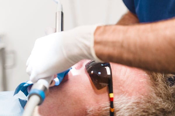 Endodoncia en Barcelona - Necrosis pulpar