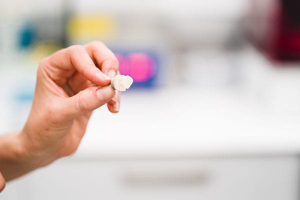 Prótesis Dental en Barcelona: Corona de zirconio recién fresada sostenida con pinza en el laboratorio