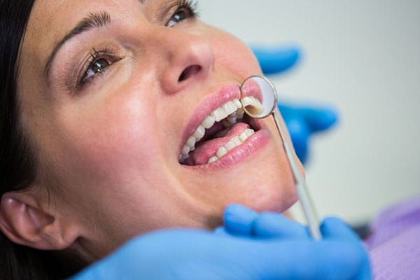 Estética Dental Barcelona - Blanqueamiento dental